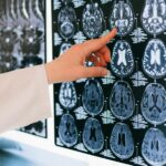 Disturbi neurologici complessi: GRIN Therapeutics e Angelini Pharma siglano un accordo di collaborazione esclusiva